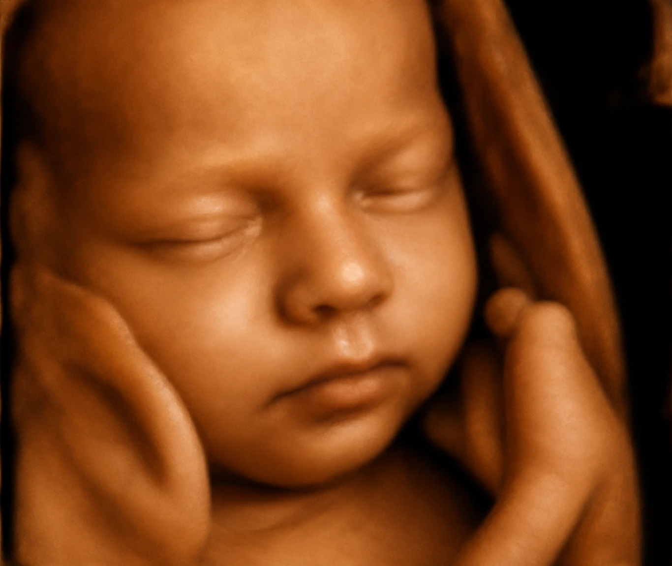 3D / 4D Ultrasound