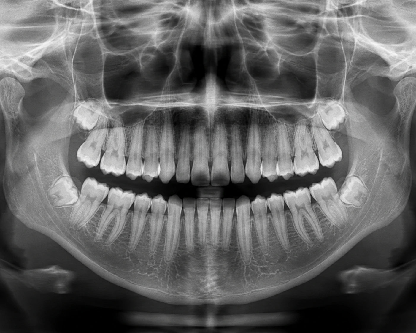 Digital X-Ray & OPG